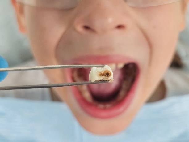 Best Pediatric Emergency Dentist in Bossier City, LA